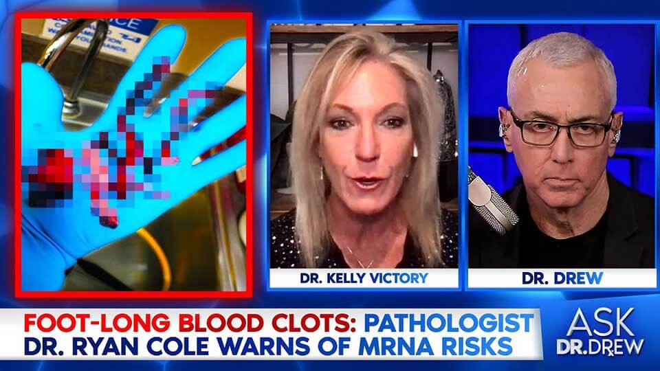 “Foot-Long Blood Clots” From mRNA, Says Pathologist Dr. Ryan Cole w/ Dr Kelly Victory ~ Ask Dr. Drew